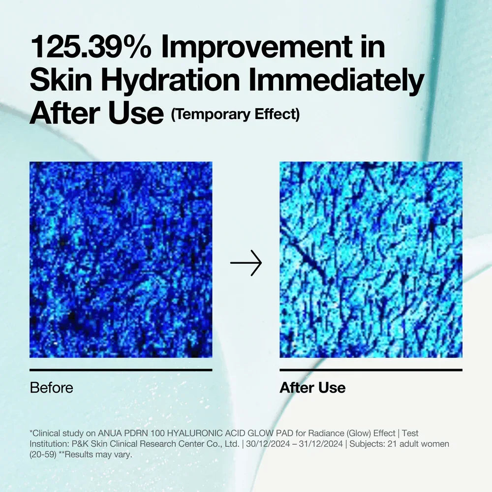 [anua] PDRN 100 Hyaluronic Acid Glow Pad 180ml 60ea