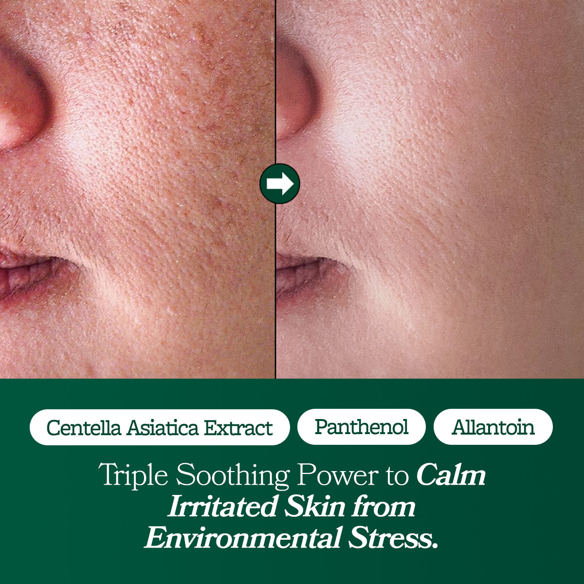 [Omitted] Fresh Lime Glow & Super Hydrating Moisturizer 80ml